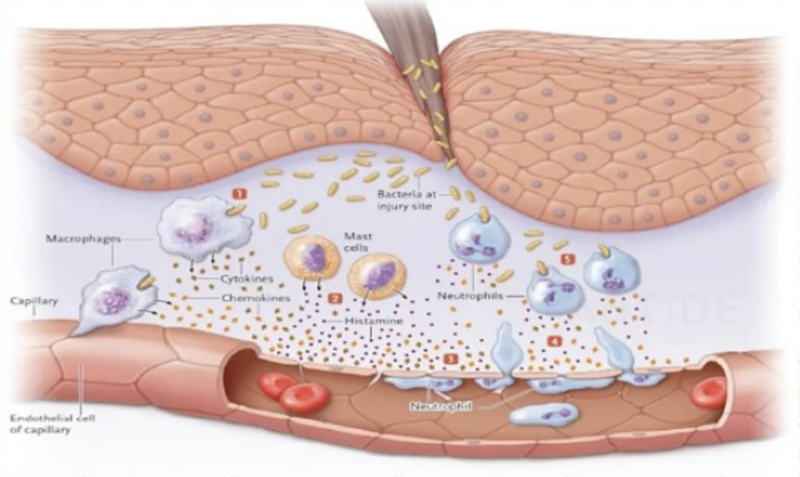 Who needs fucoidan to protect their kidneys？