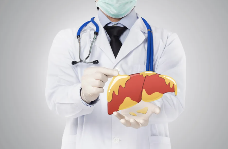 How can fucoidan reverse fatty liver?