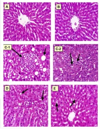 fucoidan for fatty liver.jpg